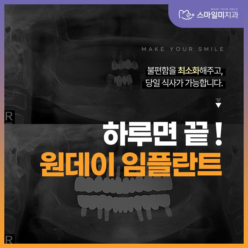 광주태전동치과