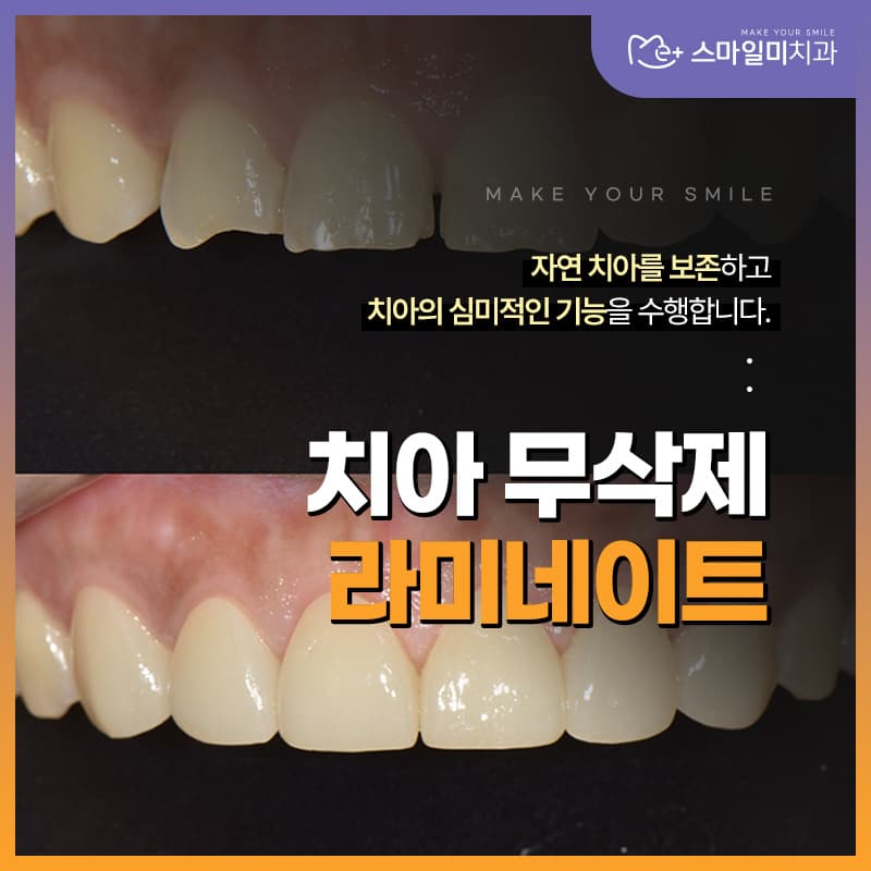 태전동임플란트